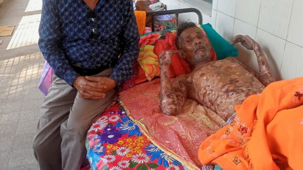 বিরল অসুখে ভোলাহাটের শ্রী শম্ভু কর্মকার চিকিৎসাধীন ॥ সহানুভূতি আশায় পরিবার